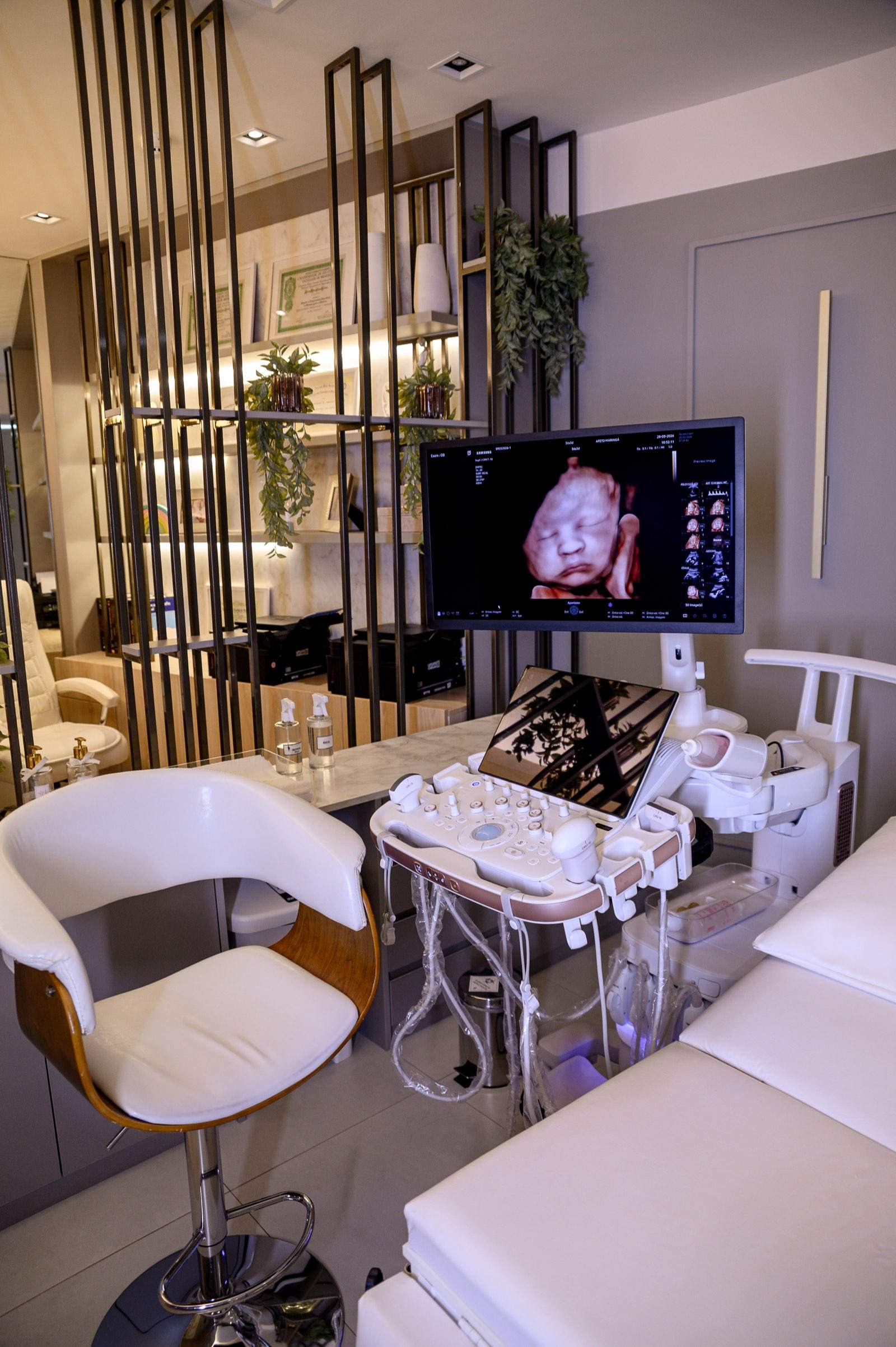 Sala de exame da Afeto Maringá com o aparelho de ultrassom e a imagem em 8D do bebê na tela