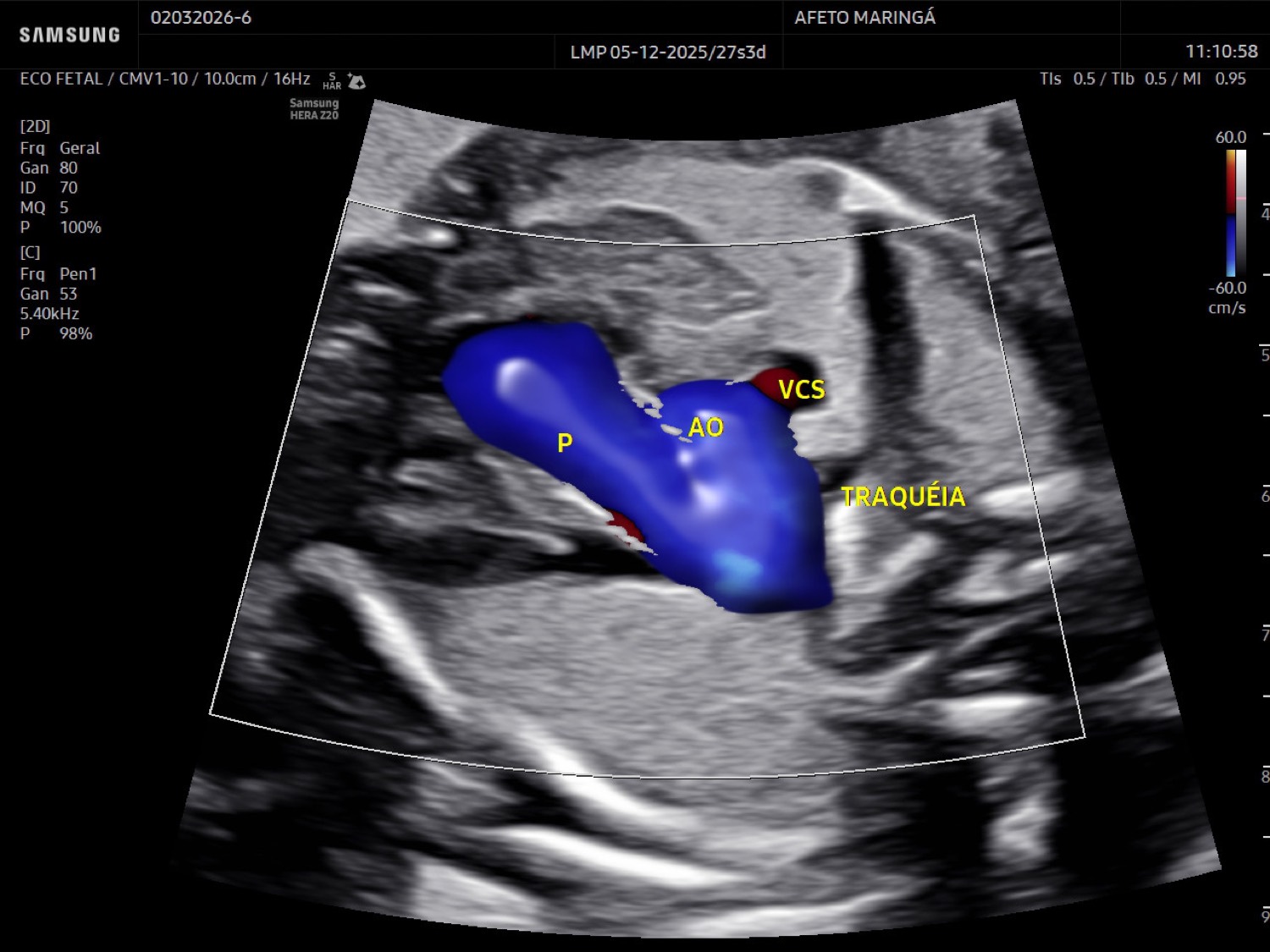 O ecocardiograma fetal avalia a anatomia do coração, as válvulas, o fluxo sanguíneo e o ritmo cardíaco do bebê.