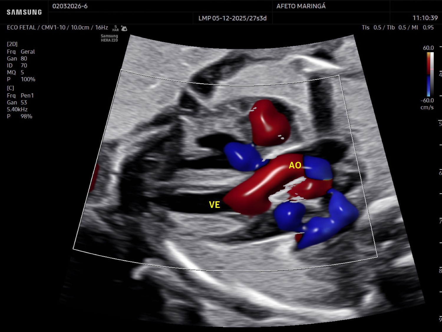 O ecocardiograma fetal avalia a anatomia do coração, as válvulas, o fluxo sanguíneo e o ritmo cardíaco do bebê.