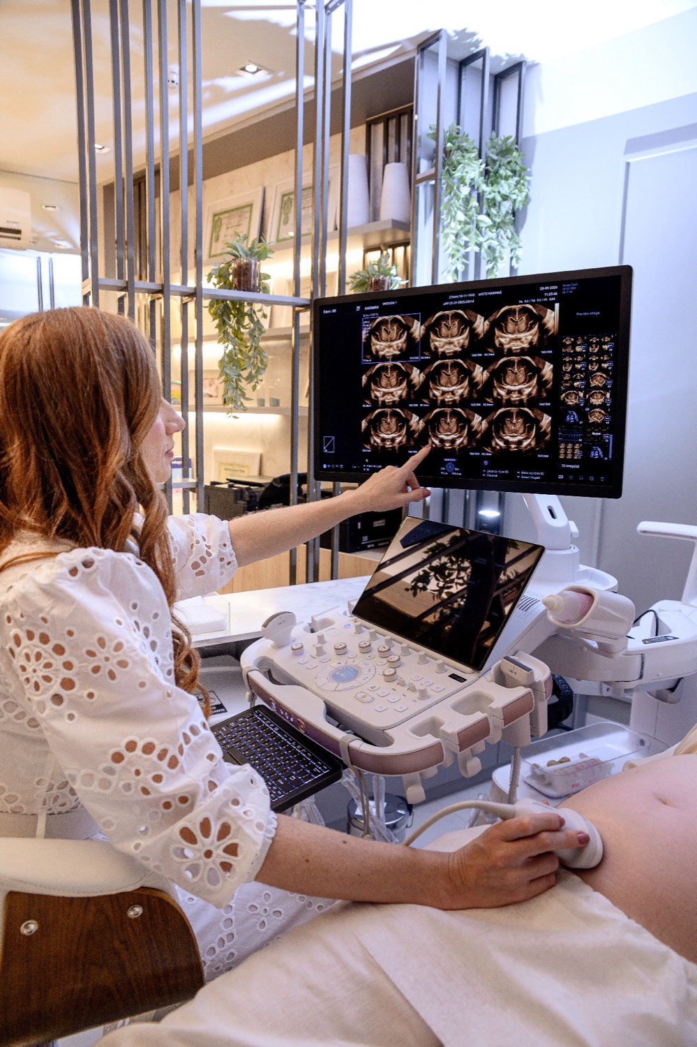 Neurossonografia fetal: o que é e quando o exame é indicado
