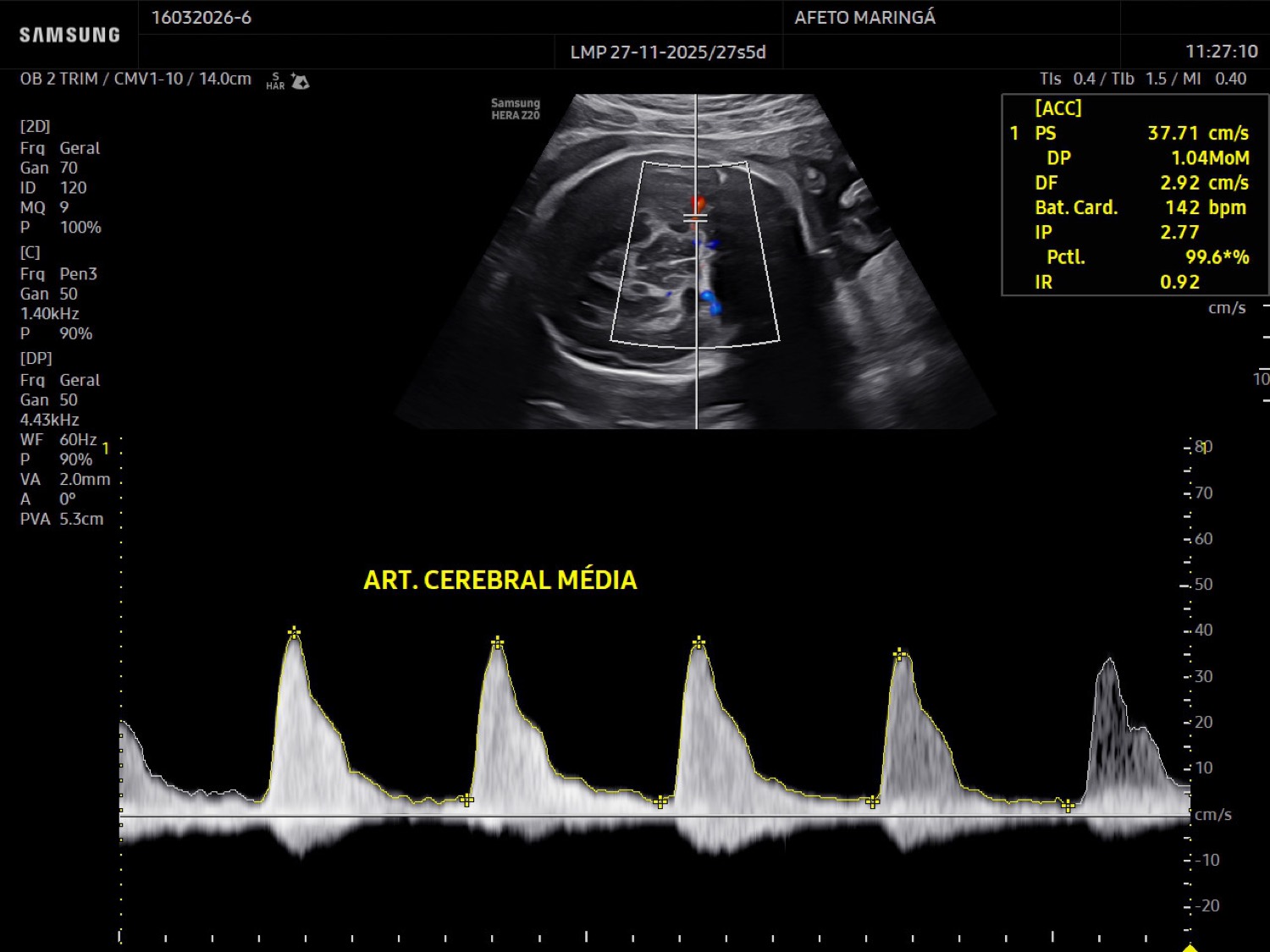 O Doppler obstétrico ajuda a monitorar a circulação entre a mãe, a placenta e o bebê ao longo da gestação.