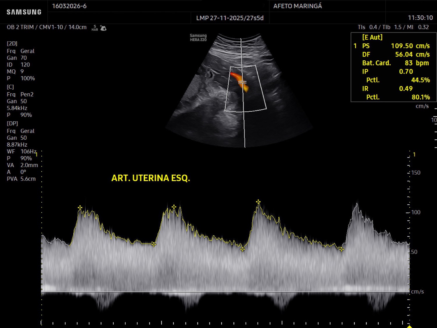 O Doppler obstétrico ajuda a monitorar a circulação entre a mãe, a placenta e o bebê ao longo da gestação.