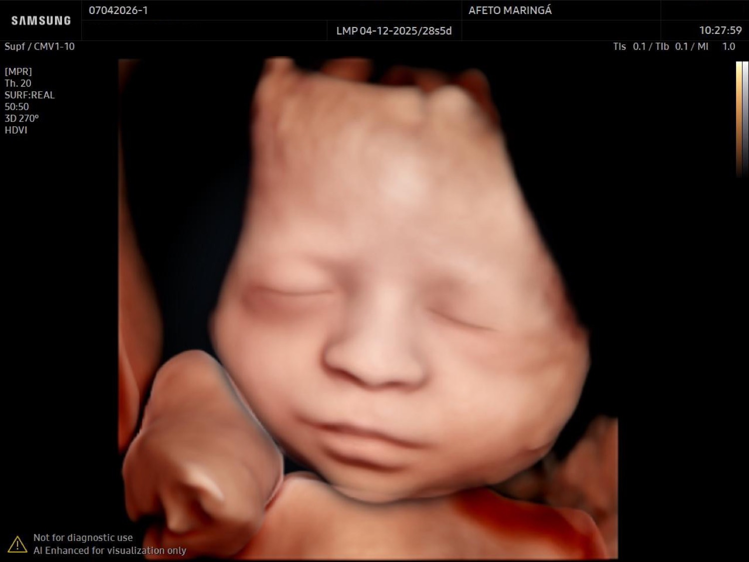 Imagem em 8D, com máxima definição e processamento por inteligência artificial.